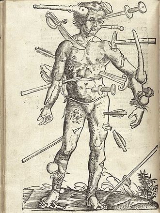 Wound Man. Diagram from medieval medical text showing one man with a large number of maladies, including being pierced by swords, arrows, and spears. Also broken bones and signs of many diseases.