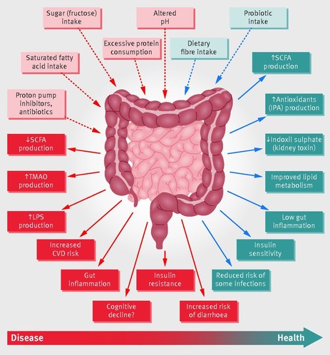 Schematic representation of the role of the gut microbiota in health and disease giving some examples of inputs and output.
